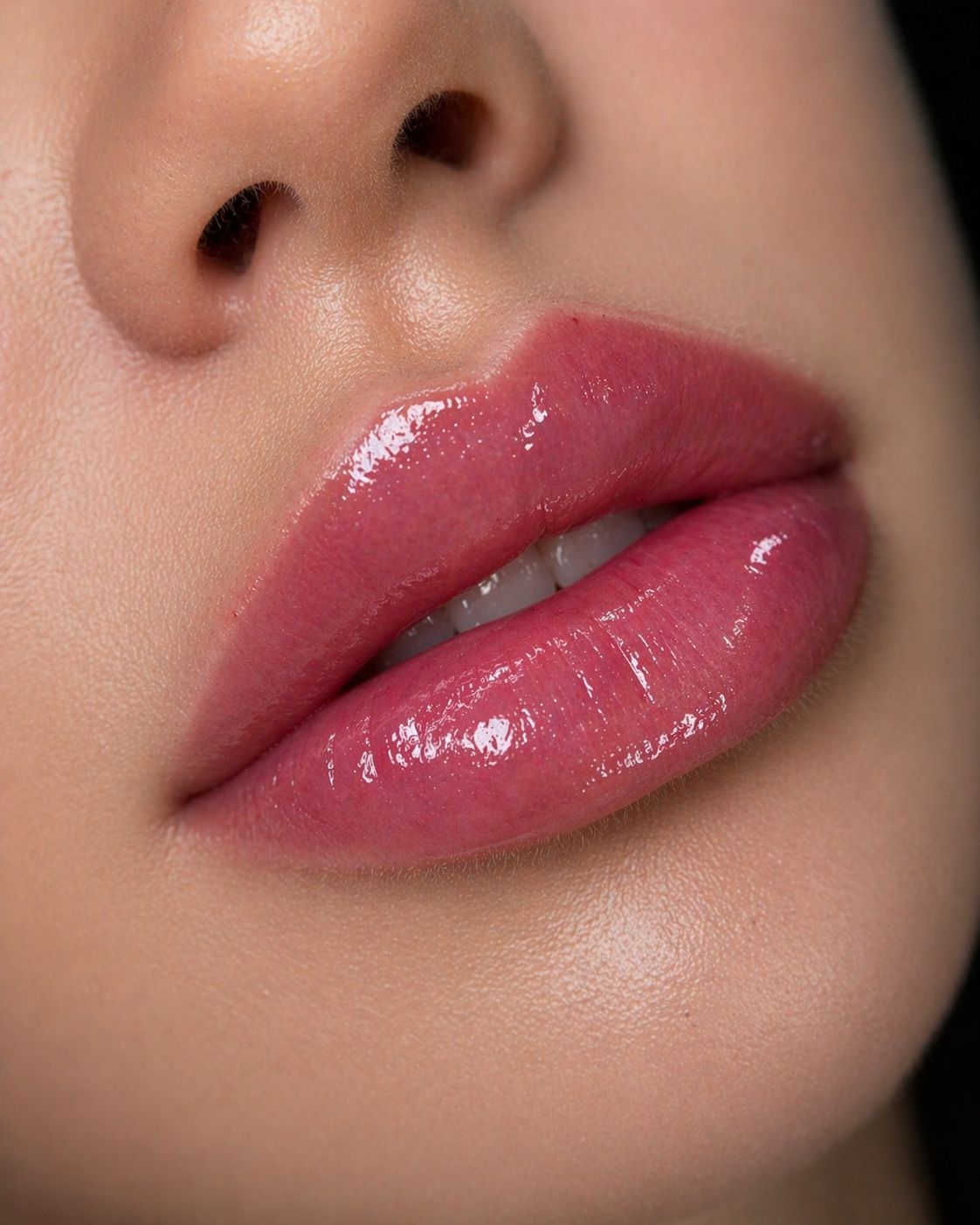 Natürliches Lippen-Ergebnis nach Hyaluron-Unterspritzung – Close-up gepflegte Lippen